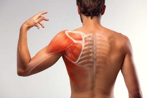 Muscle Strain