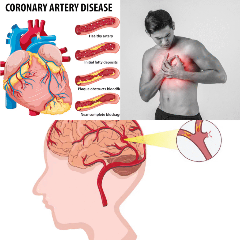 cardiovascular Health