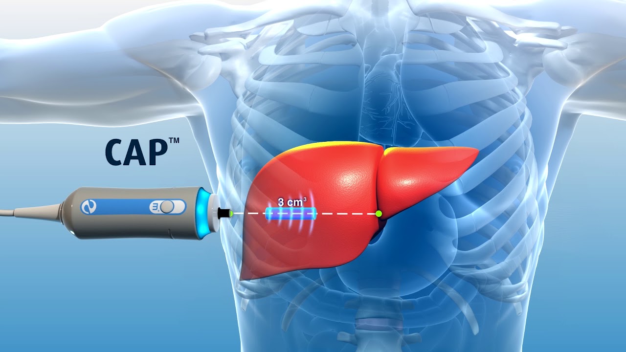 Liver Treatment