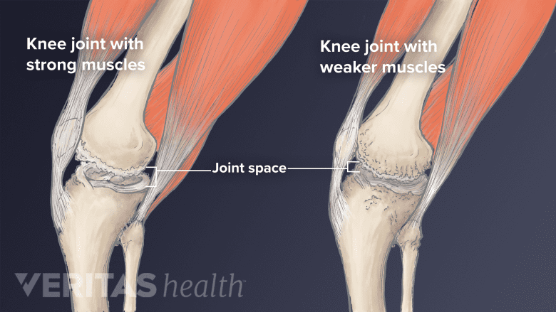5 knee strengthening exercises